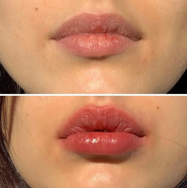 LIP PLUMPER