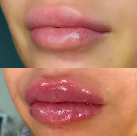 LIP PLUMPER